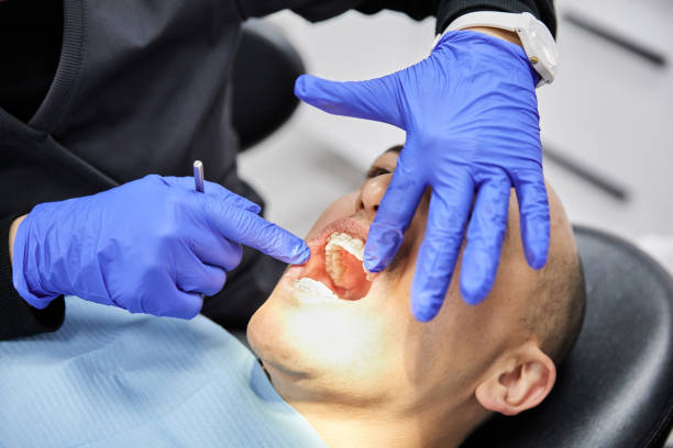Best Emergency Wisdom Tooth Extraction in Neoga, IL
